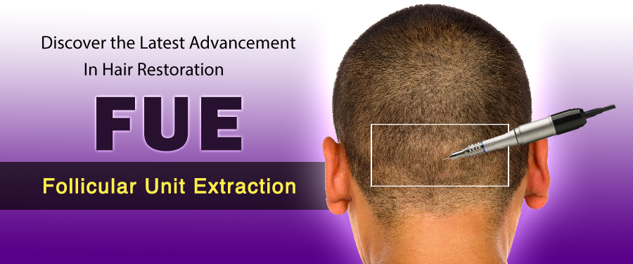 exercise to regrow hair on bald scalp